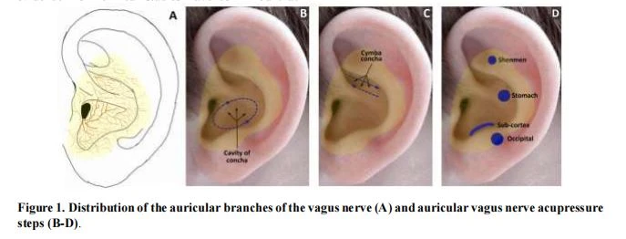 Distribution of the auricular branches Distribution of the auricular branches